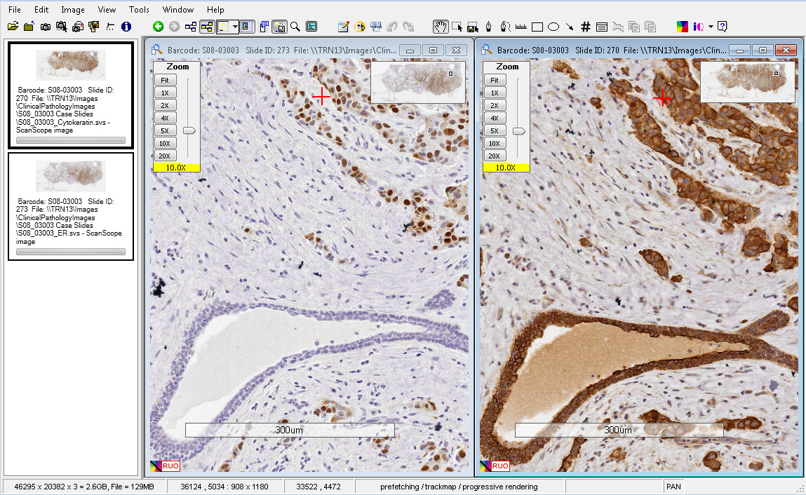 Aperio ImageScope 分析系统病理流程追踪系统厂家批发北京悦昌行科技有限公司